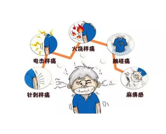 一代宗師素樸中醫(yī)院講述如何用棉花灸治療帶狀皰疹
